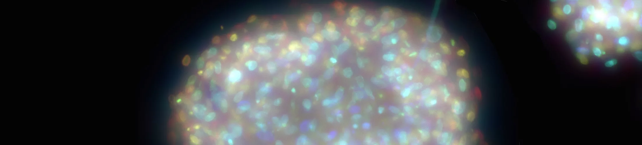 Photo illustrant un sphéroïde de cellules souches mésenchymateuses
