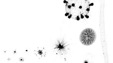 Photo de protistes géants au microscope